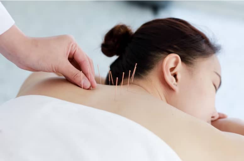 What to Tell Your Acupuncturist for a Personalized Treatment