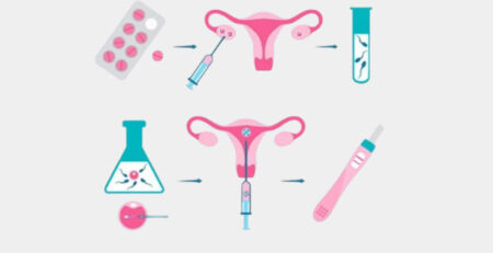 Infertility Treatment For Women | Dr. Rhythm Gupta